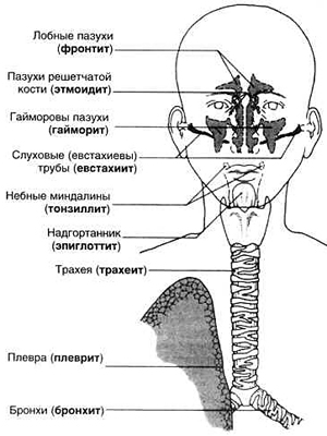 Заболевания дыхательной системы